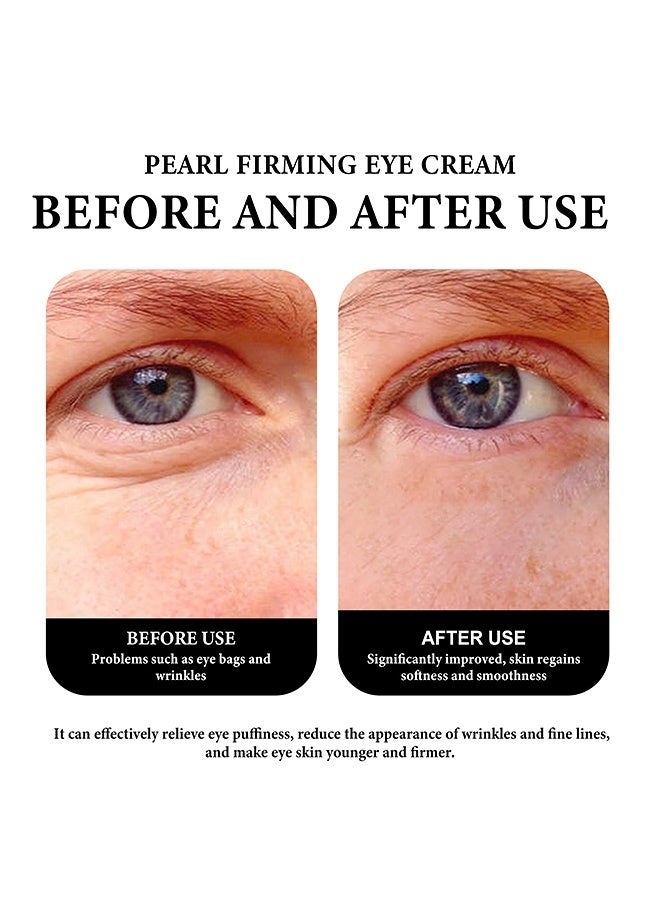 WIYUN Eye Cream-Gentle and moisturizing care for the eye area, with soft massage for delicate skin. Hydrating skin care lotion (30g) - Image 5